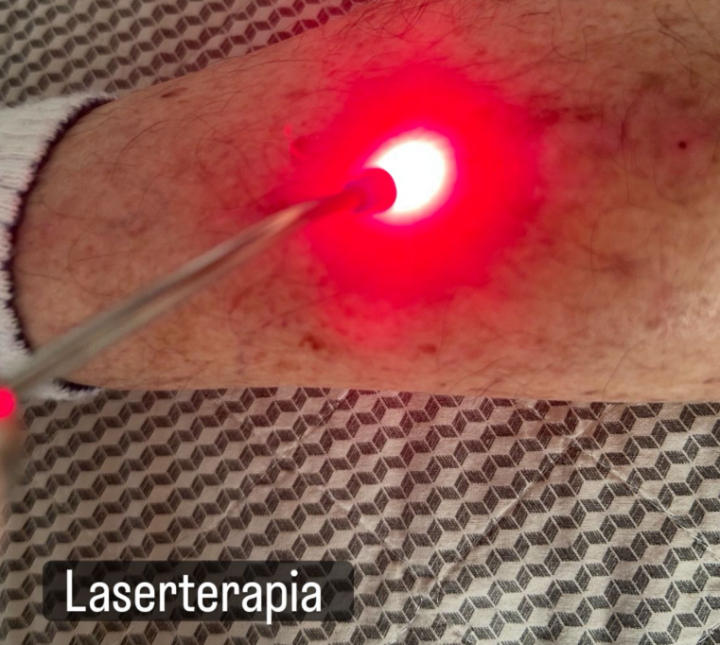 Fisioterapia